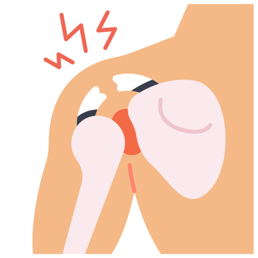 Shoulder Subluxation